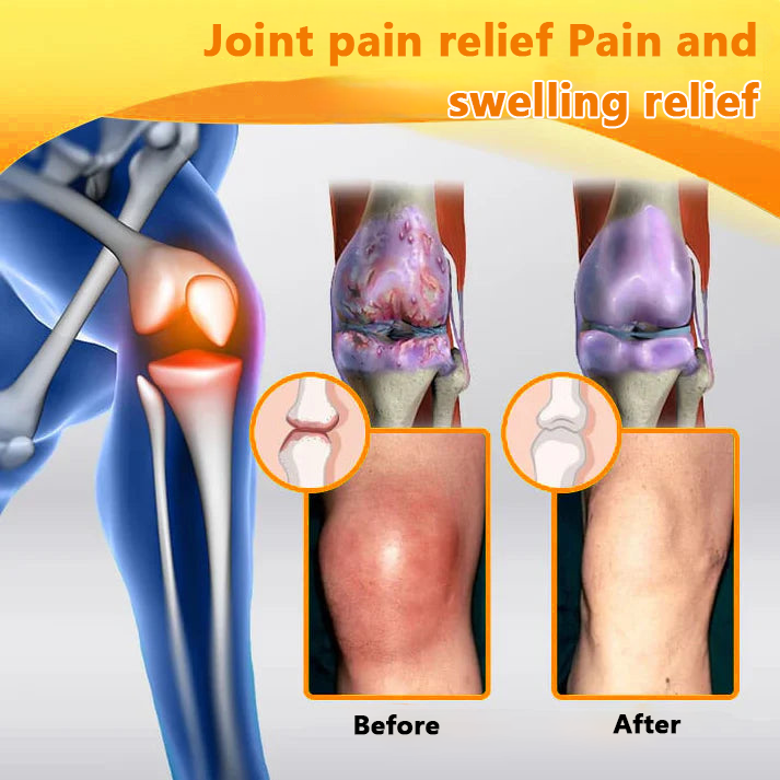 ✅Official Store: LOVILDS™ Magnesium Oil and Honey Spray for Joint Repair👨‍⚕️