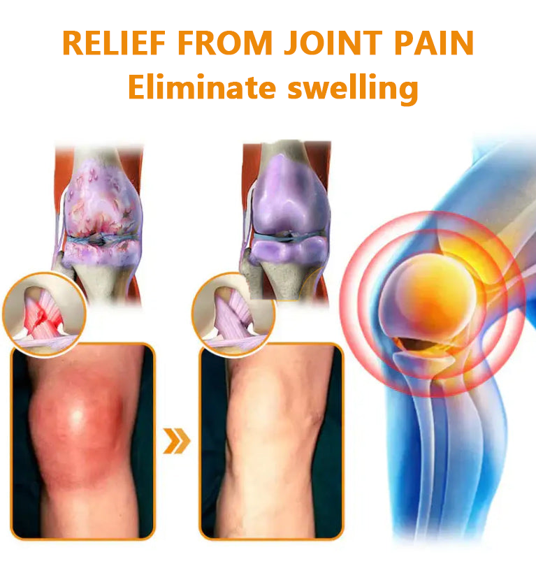 ✅Official Store: LOVILDS™ Magnesium Oil and Honey Spray for Joint Repair👨‍⚕️