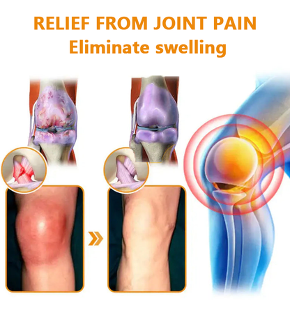 ✅Official Store: LOVILDS™ Magnesium Oil and Honey Spray for Joint Repair👨‍⚕️