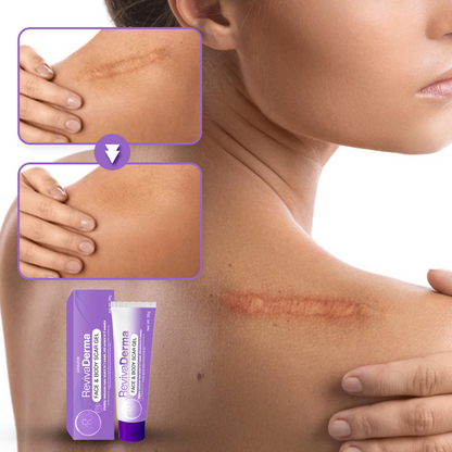 LOVILDS® RevivaDerma Face & Body Scar Gel - Clinically proven to soften, flatten and fade surgical scars, acne marks, burns, keloids and trauma-related scars