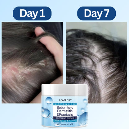 LOVILDS™ Scalp Relief Bal