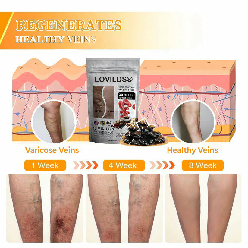 🌿LOVILDS™ Herbal VenoDetox Foot Bath Beads🌲(𝐋𝐀𝐍𝐀 𝐂𝐞𝐫𝐭𝐢𝐟𝐢𝐜𝐚𝐭𝐢𝐨𝐧，𝗟𝘆𝗺𝗽𝗵𝗮𝘁𝗶𝗰 𝗔𝘀𝘀𝗼𝗰𝗶𝗮𝘁𝗶𝗼𝗻 𝗼𝗳 𝗔𝗺𝗲𝗿𝗶𝗰𝗮)