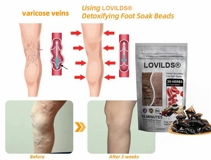 🌿LOVILDS™ Herbal VenoDetox Foot Bath Beads🌲(𝐋𝐀𝐍𝐀 𝐂𝐞𝐫𝐭𝐢𝐟𝐢𝐜𝐚𝐭𝐢𝐨𝐧，𝗟𝘆𝗺𝗽𝗵𝗮𝘁𝗶𝗰 𝗔𝘀𝘀𝗼𝗰𝗶𝗮𝘁𝗶𝗼𝗻 𝗼𝗳 𝗔𝗺𝗲𝗿𝗶𝗰𝗮)
