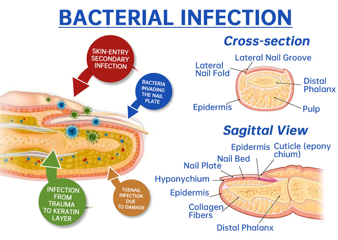 【Official Brand Store】QIAWI™ NailRefresh Fungus Laser Device