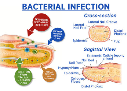 【Official Brand Store】QIAWI™ NailRefresh Fungus Laser Device