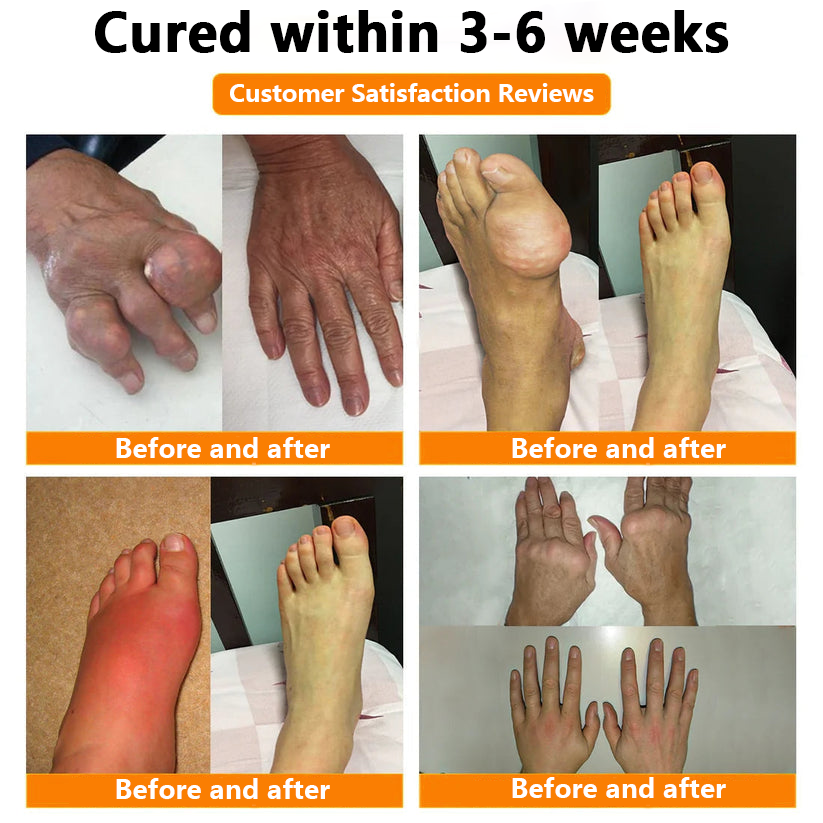 ✅Official Store: LOVILDS™ Magnesium Oil and Honey Spray for Joint Repair👨‍⚕️