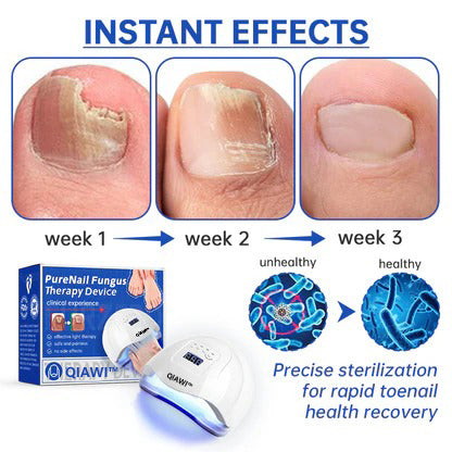 【Official Brand Store】QIAWI™ NailRefresh Fungus Laser Device