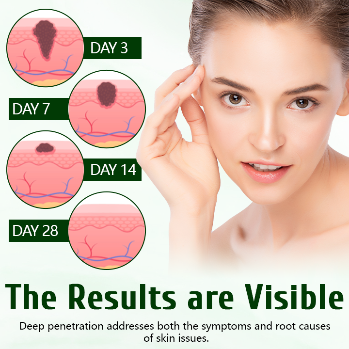 LOVILDS™  Tea Tree Healing Cream