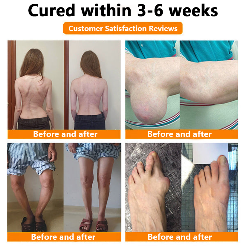 ✅Official Store: LOVILDS™ Magnesium Oil and Honey Spray for Joint Repair👨‍⚕️