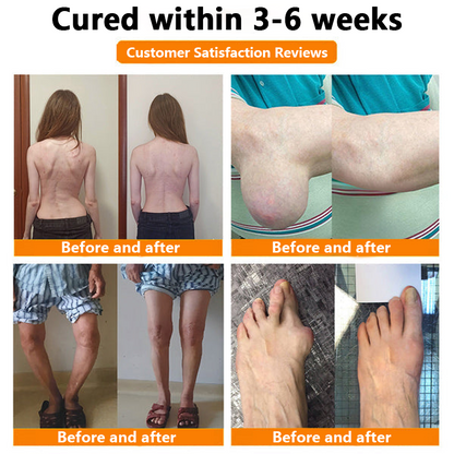 ✅Official Store: LOVILDS™ Magnesium Oil and Honey Spray for Joint Repair👨‍⚕️