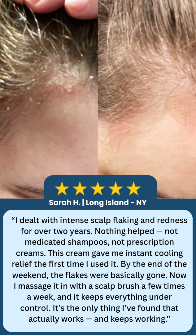 LOVILDS™ Scalp Relief Bal