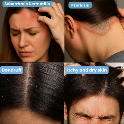 LOVILDS™ Scalp Relief Bal