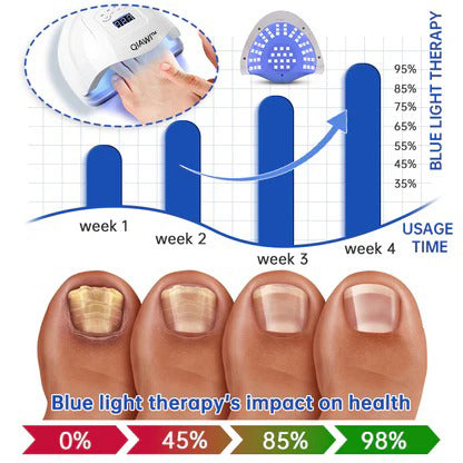 【Official Brand Store】QIAWI™ NailRefresh Fungus Laser Device