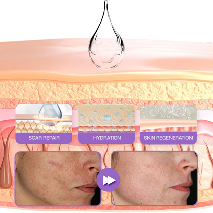 LOVILDS® RevivaDerma Face & Body Scar Gel - Clinically proven to soften, flatten and fade surgical scars, acne marks, burns, keloids and trauma-related scars