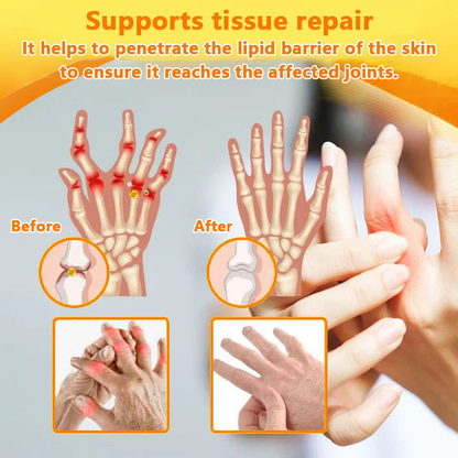 ✅Official Store: LOVILDS™ Magnesium Oil and Honey Spray for Joint Repair👨‍⚕️