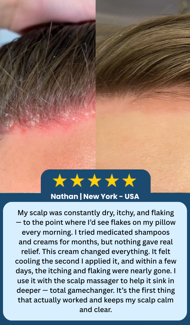 LOVILDS™ Scalp Relief Bal