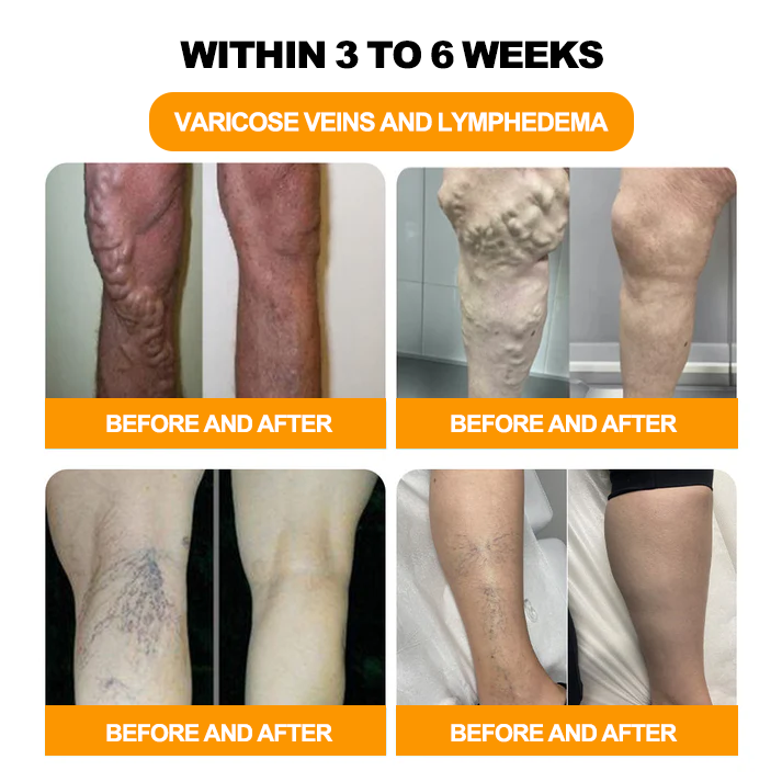 🌿LOVILDS™ Herbal VenoDetox Foot Bath Beads🌲(𝐋𝐀𝐍𝐀 𝐂𝐞𝐫𝐭𝐢𝐟𝐢𝐜𝐚𝐭𝐢𝐨𝐧，𝗟𝘆𝗺𝗽𝗵𝗮𝘁𝗶𝗰 𝗔𝘀𝘀𝗼𝗰𝗶𝗮𝘁𝗶𝗼𝗻 𝗼𝗳 𝗔𝗺𝗲𝗿𝗶𝗰𝗮)