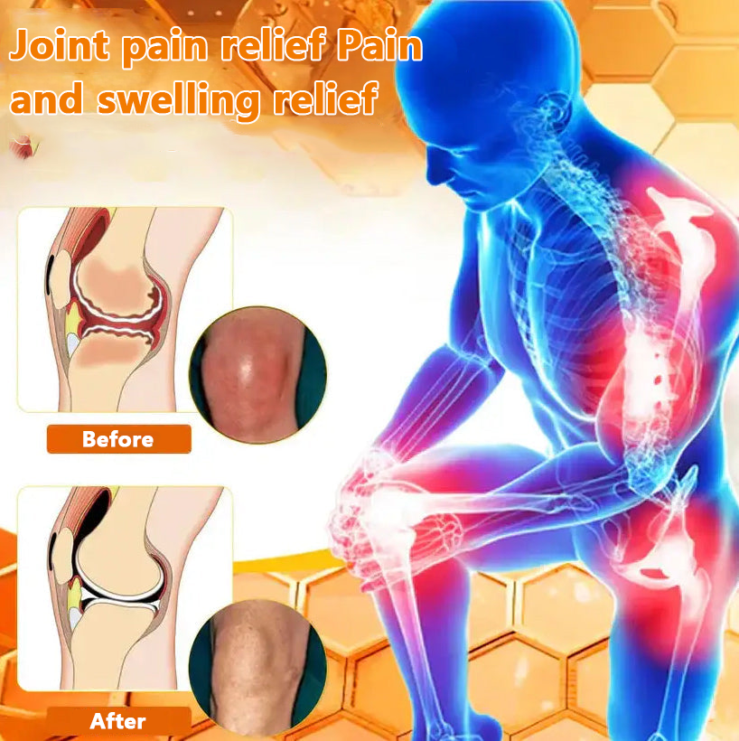 ✅Official Store: LOVILDS™ Magnesium Oil and Honey Spray for Joint Repair👨‍⚕️