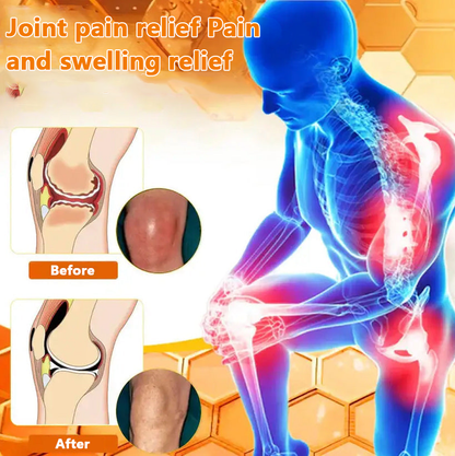 ✅Official Store: LOVILDS™ Magnesium Oil and Honey Spray for Joint Repair👨‍⚕️