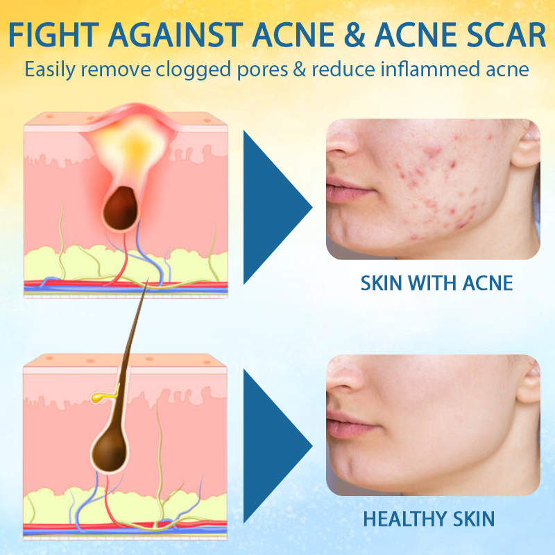 LOVILDS® Psoriasis Care Mellifera Venom Skin Healing Spray🔥