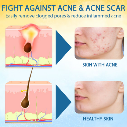 LOVILDS® Psoriasis Care Mellifera Venom Skin Healing Spray🔥