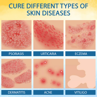 LOVILDS® Psoriasis Care Mellifera Venom Skin Healing Spray🔥