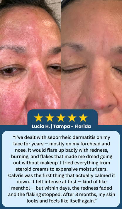 LOVILDS™ Scalp Relief Bal