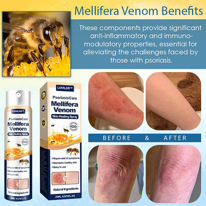 LOVILDS® Psoriasis Care Mellifera Venom Skin Healing Spray🔥
